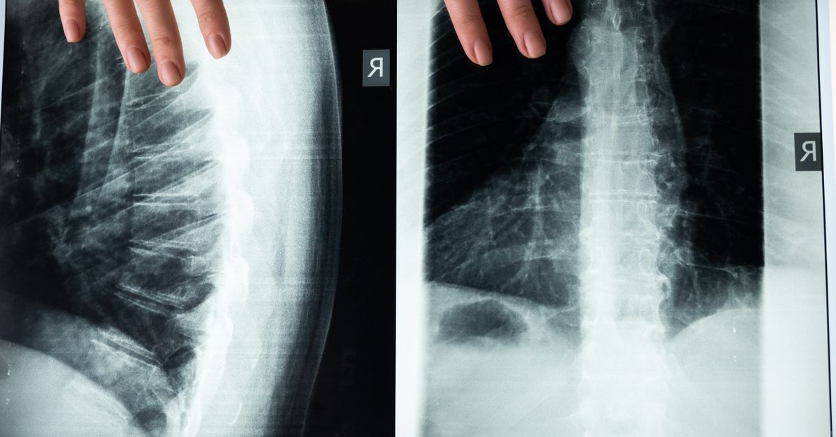 AI-enabled radiology reporting across tier-2 and tier-3 cities