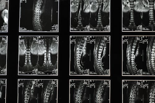 Imagine de stoc gratuită din a închide, anatomie, coloană vertebrală