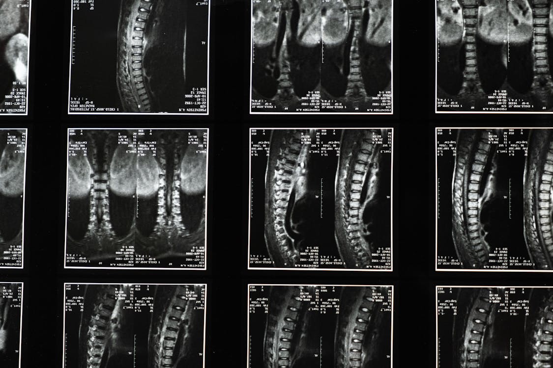 Medical Images of the Backbone · Free Stock Photo
