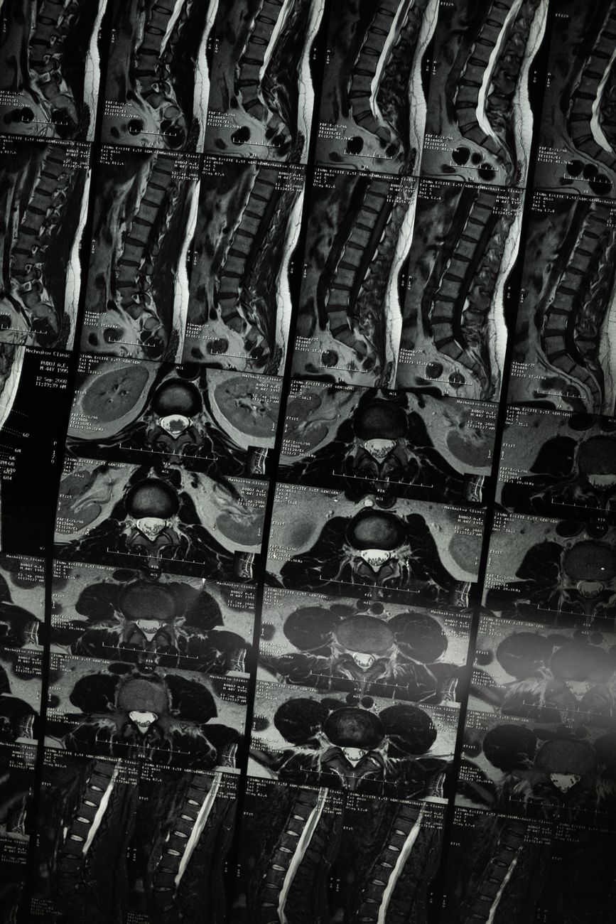 High-resolution radiological x-ray series displaying the complex structure of the human spine for medical examination