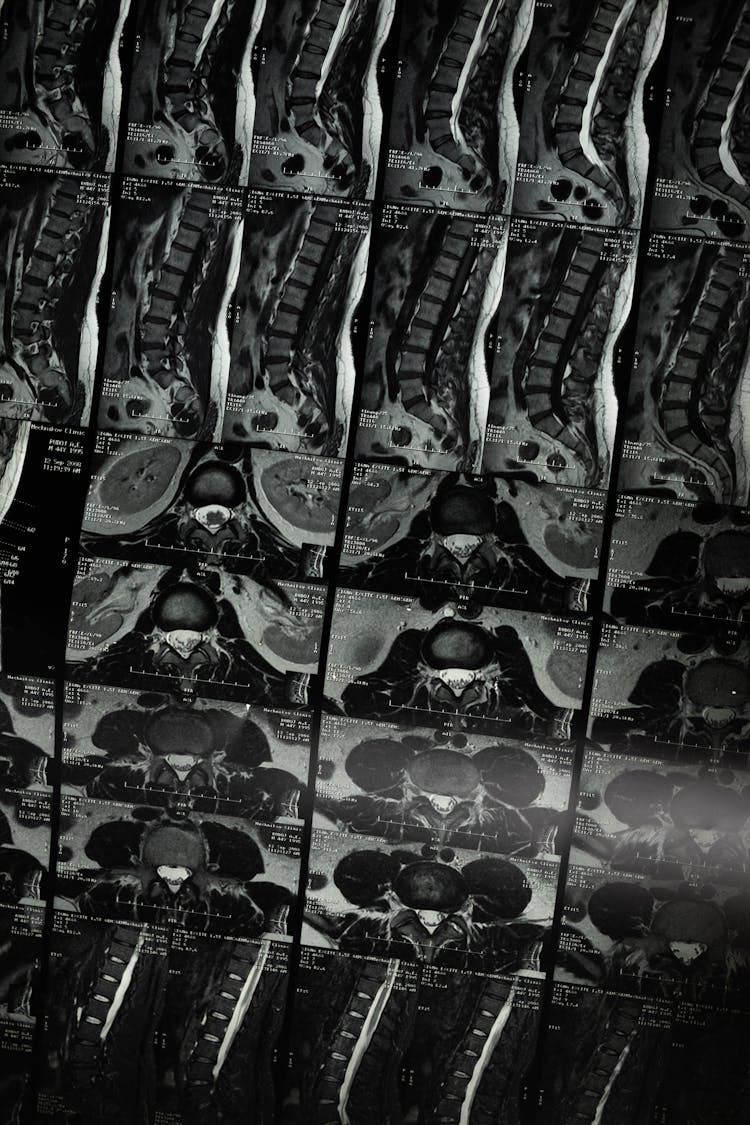 A Medical Imaging Examination Of The Spine