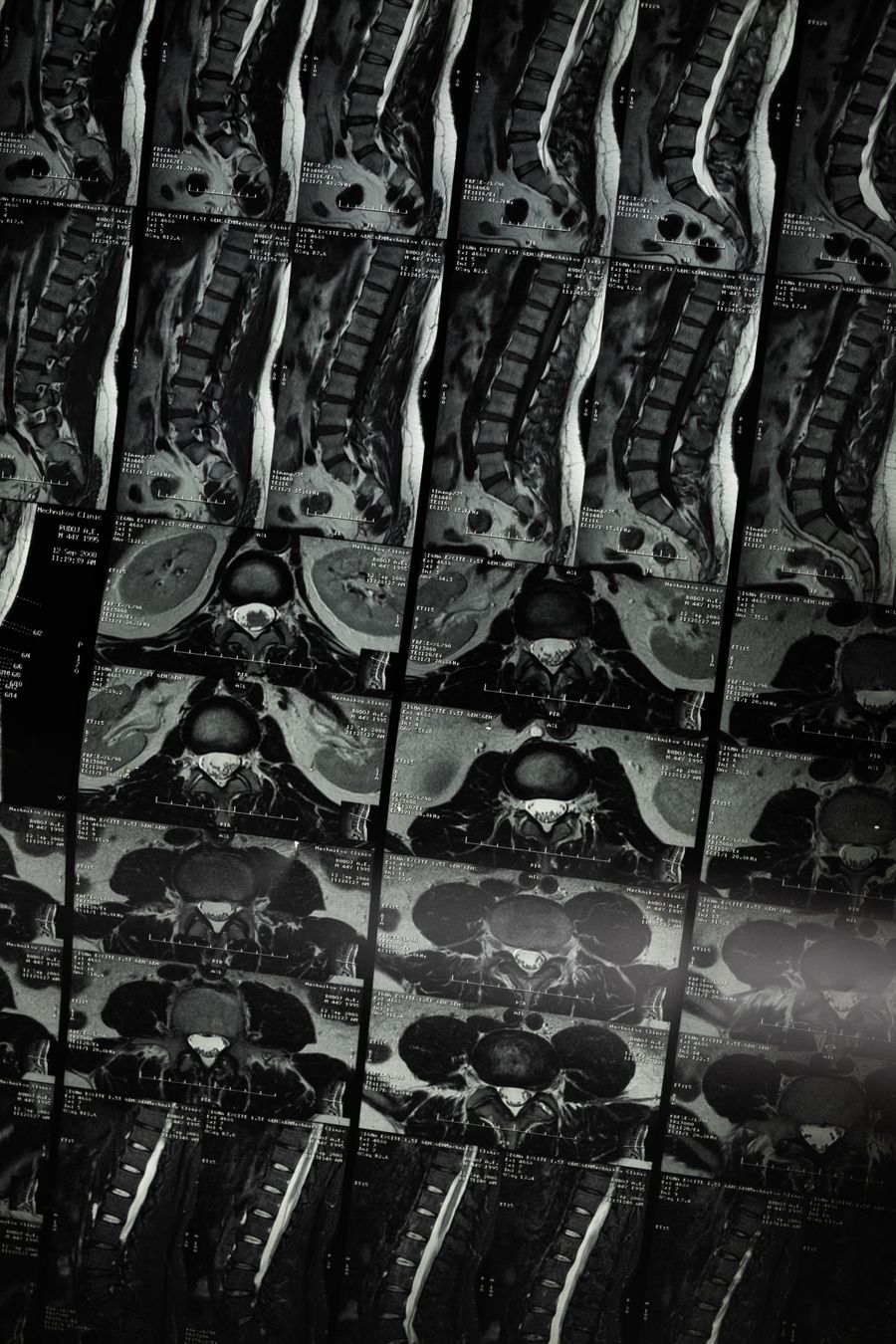Imagem medica de coluna