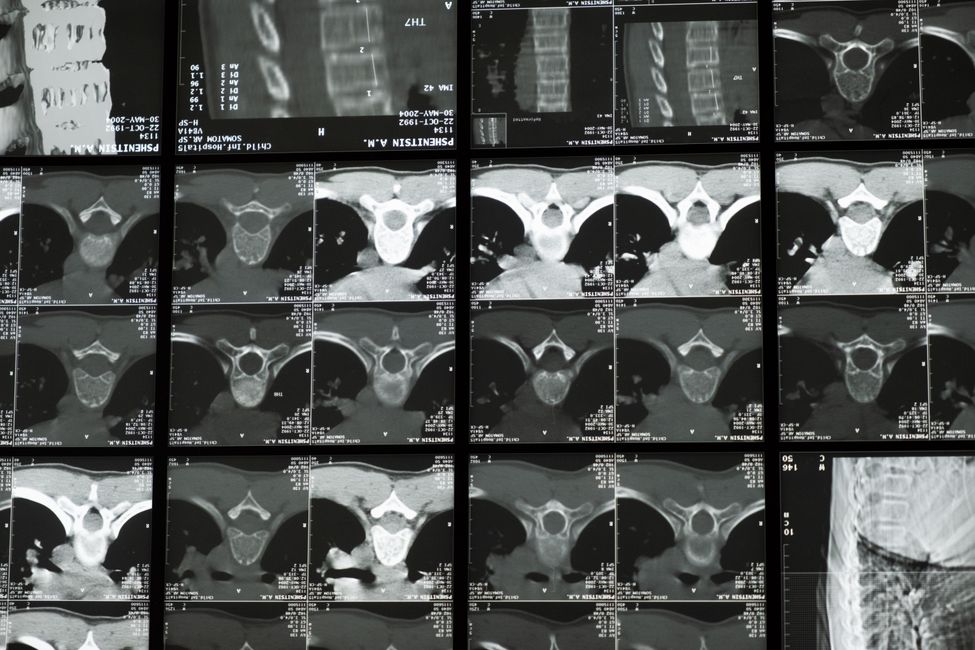 brain scan medical imaging