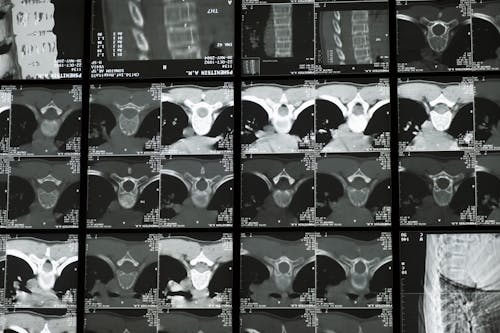 Imagine de stoc gratuită din anatomie, coloană vertebrală, examinare