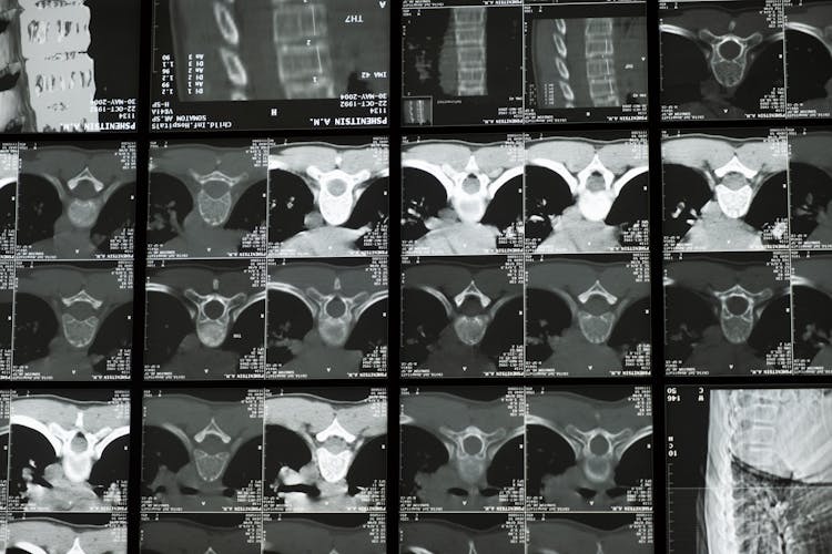 Medical Imaging Examination Of The Spine