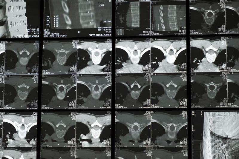 Neurological spine health imaging