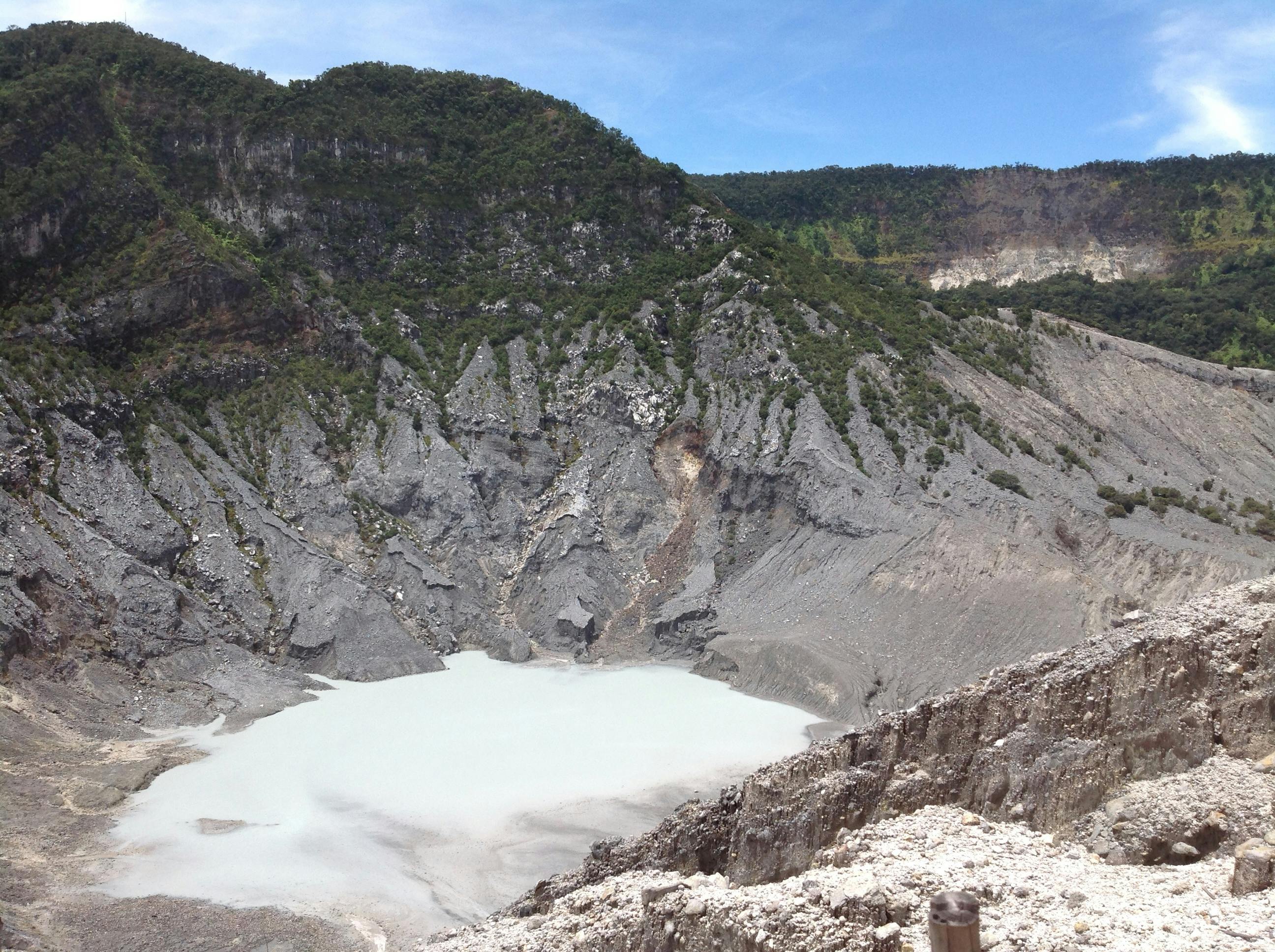 胸膜炎CT扫描图