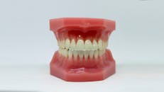 A Dental Model on a White Surface