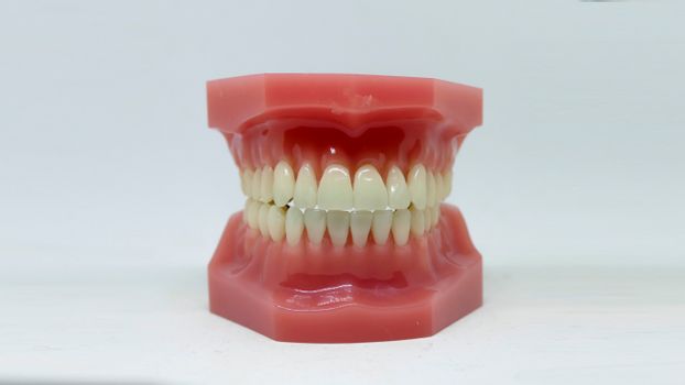 A Dental Model on a White Surface