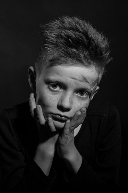 Free Black and white portrait of a young boy with freckles and hands on face, conveying emotion. Stock Photo