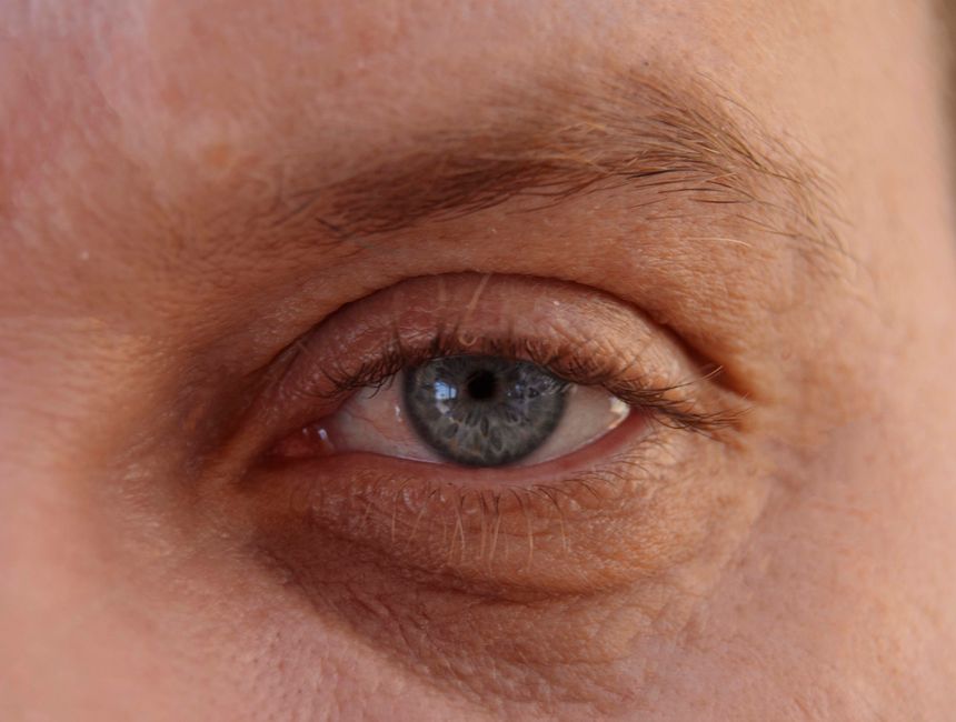 rapid wrinkle repair eye cream