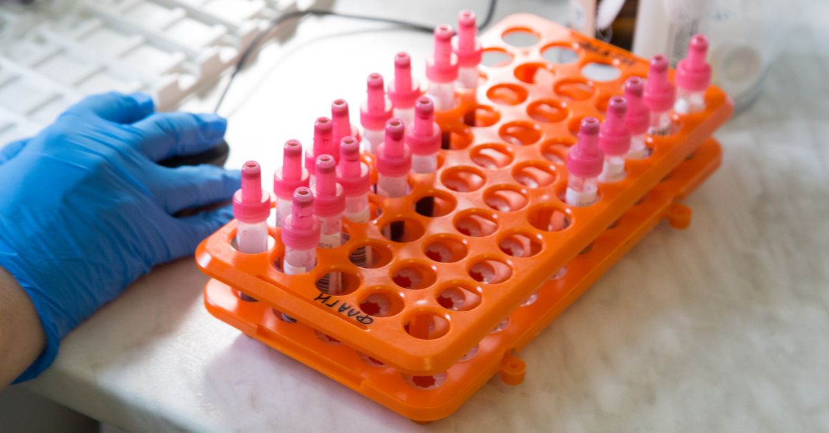 Various test tubes in an orange rack inside a laboratory setting. - Evidence evidence guide for astaxanthin skin photoaging randomized trial