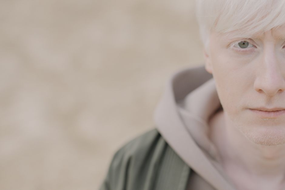 Close-up portrait of a young albino man looking at the camera outdoors with a serene expression.