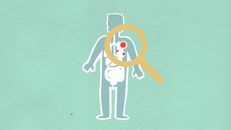 Paper cutout of man under magnifying glass with red viruses spreading on internal organs on green background during disease propagation
