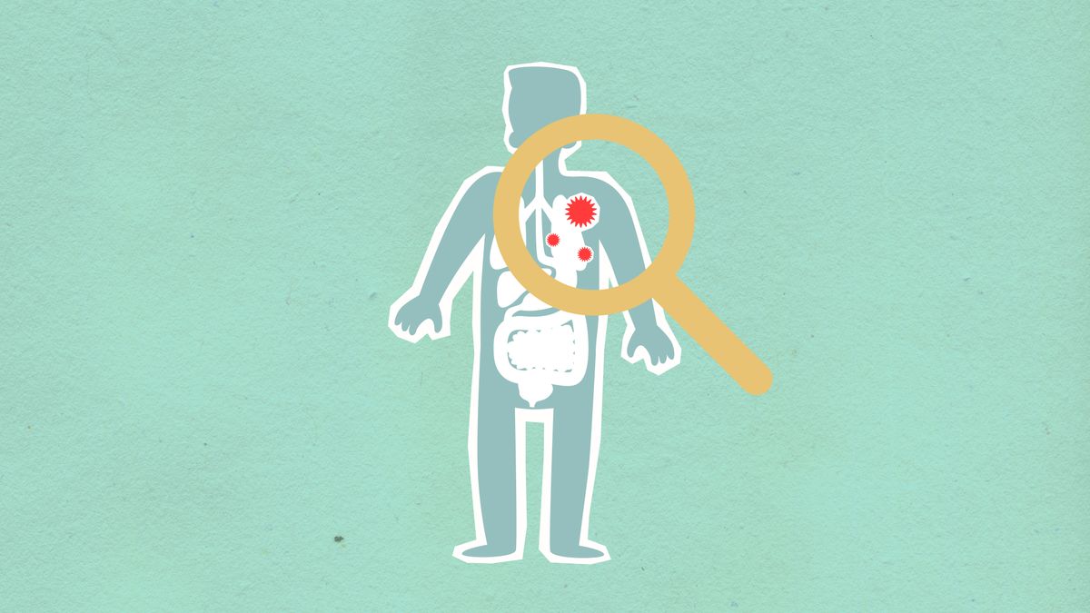 IA et analyse d'urine : traquer l'infection par métagénomique