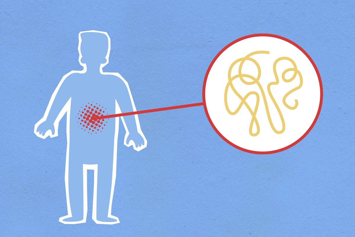 Candidose intestinale : régime anti-Candida - Les principes fondamentaux du régime anti-Candida
