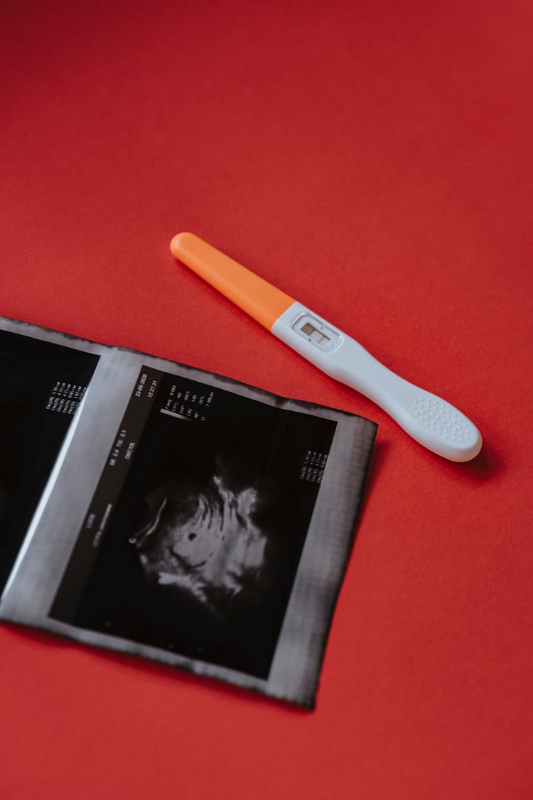 A Pregnancy Test And A Sonogram