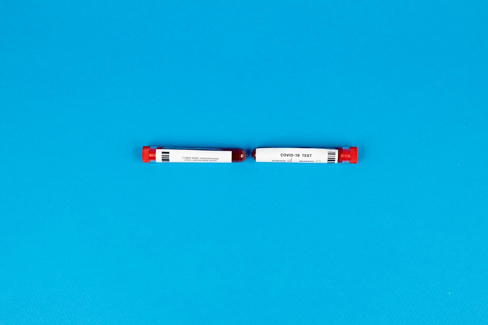 Medical Test Tubes with Blood Sample and Label on Blue Background