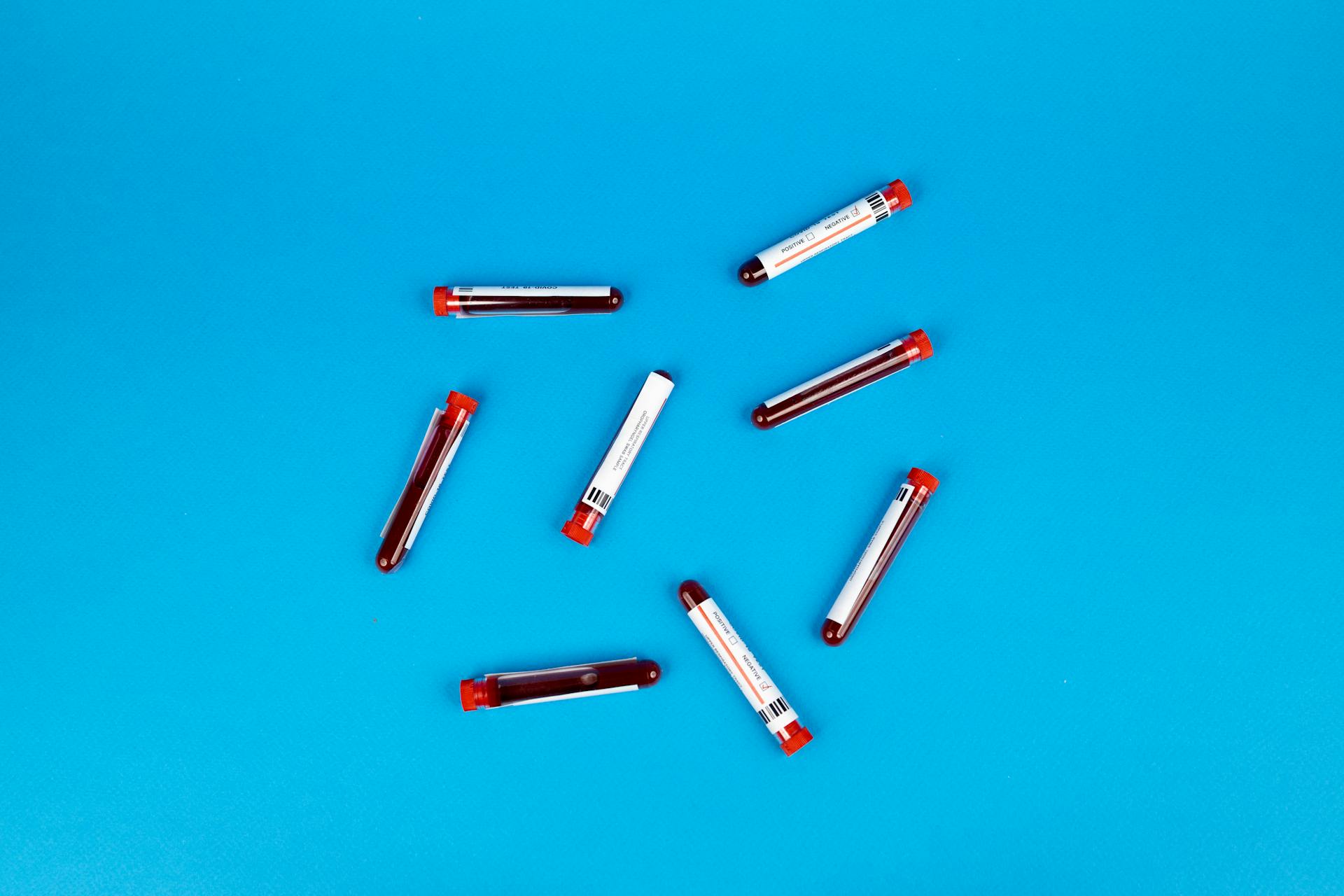 A Close-Up Shot of Blood Samples on a Blue Surface