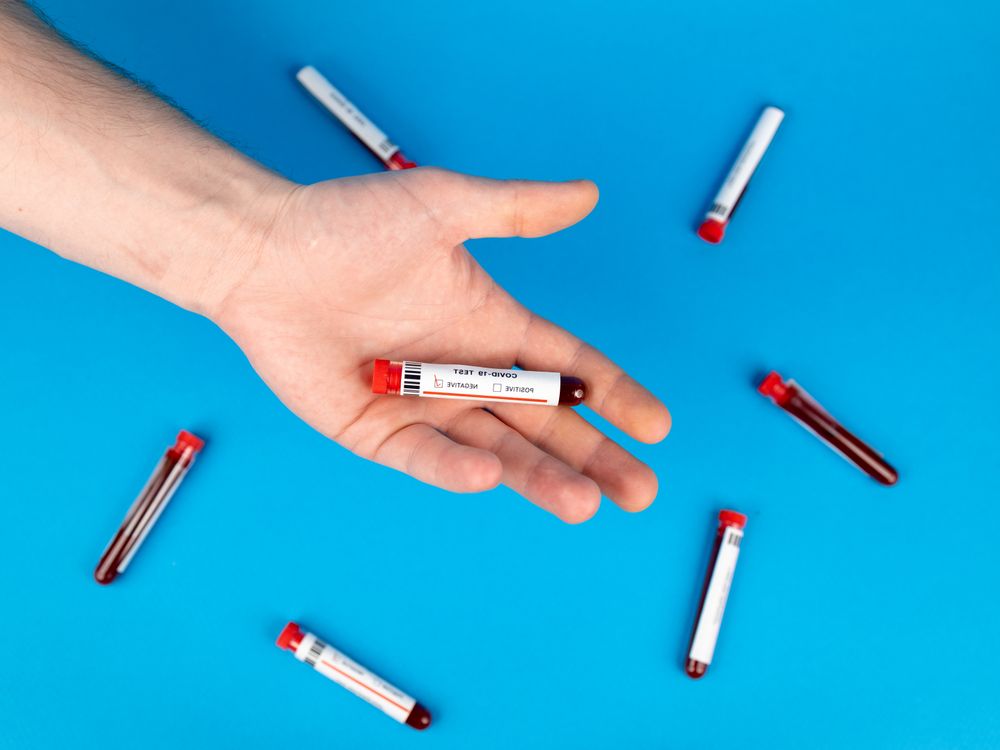 Blood sample vial in a hand