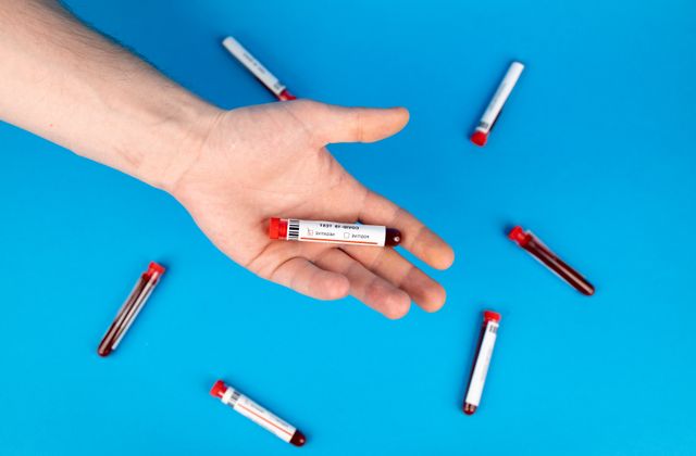 Blood sample vial in a hand