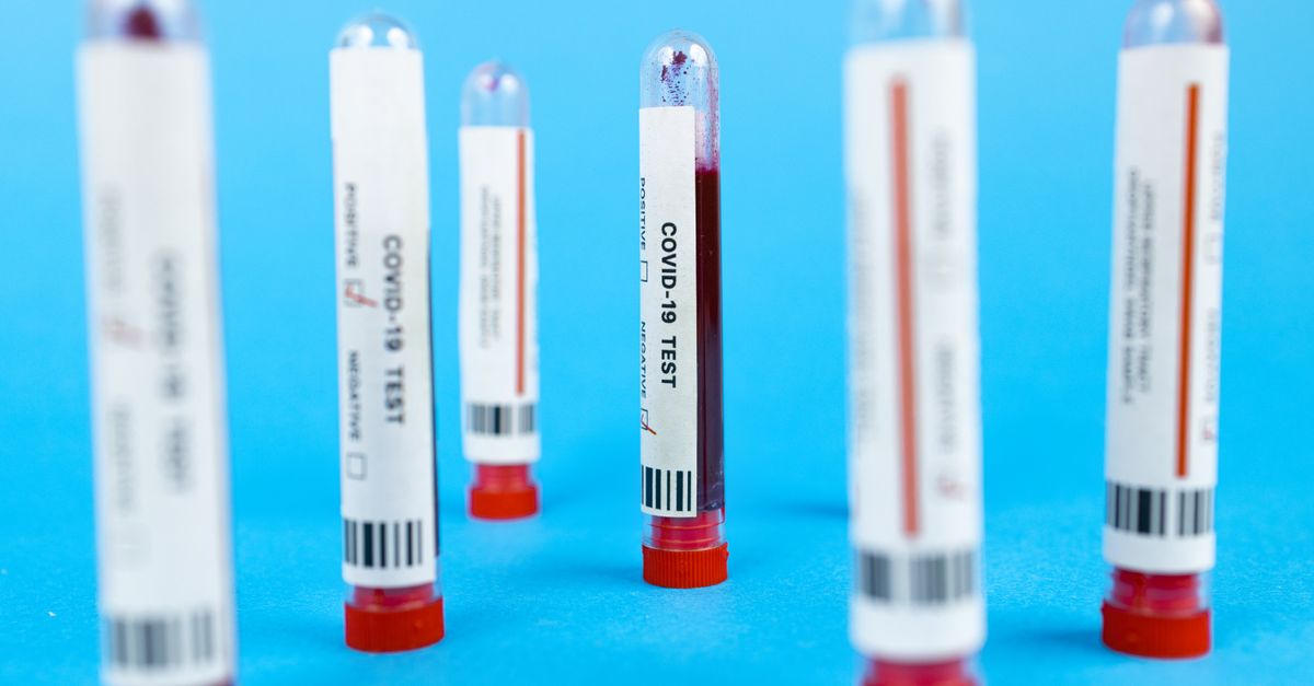 Molbio Diagnostics Reports Rs 52.7 Crore Profit in Q1 After IPO Success