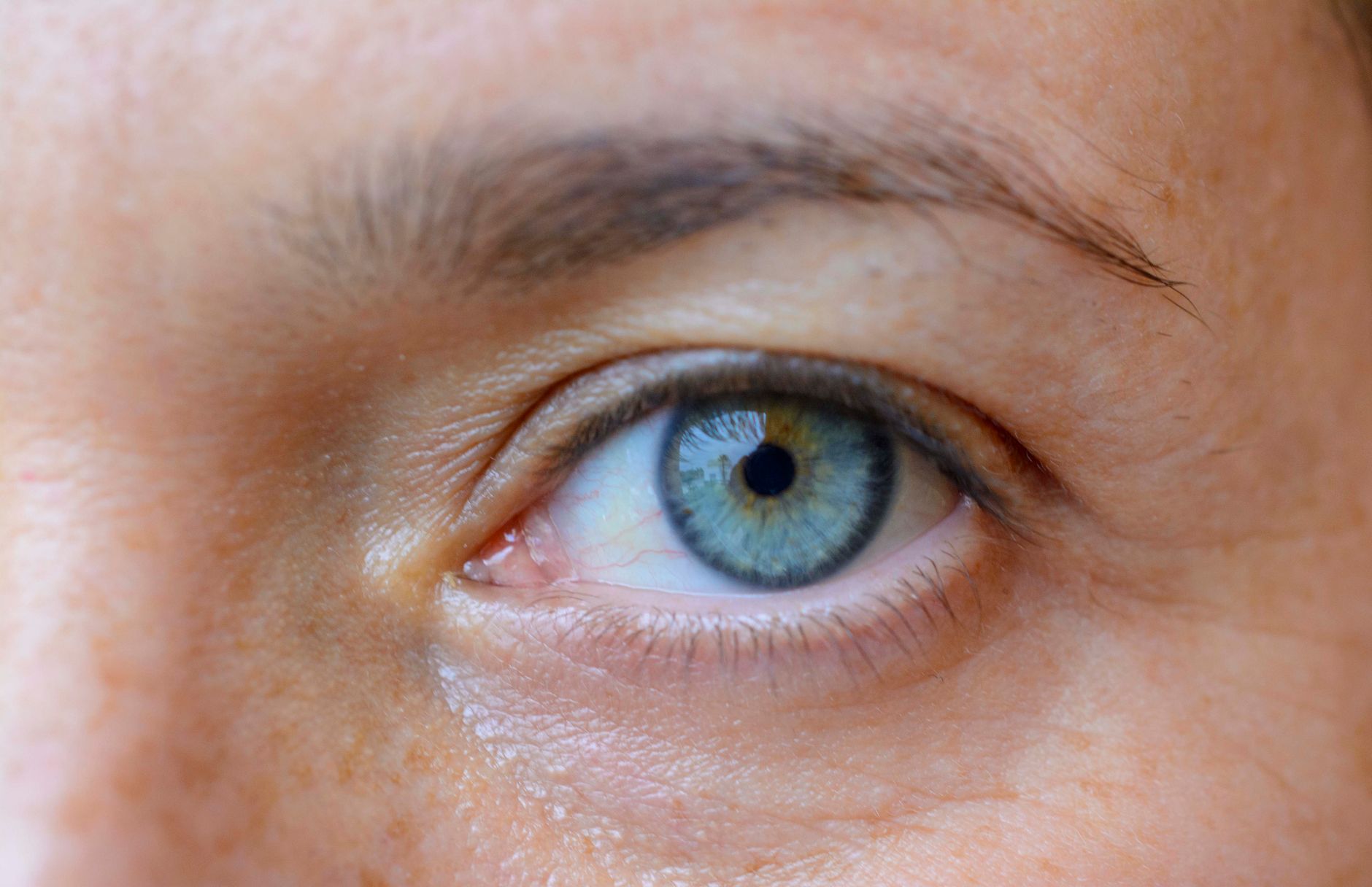 Say Goodbye to Itchy, Watery Eyes: Your Guide to Allergy Eye Drops