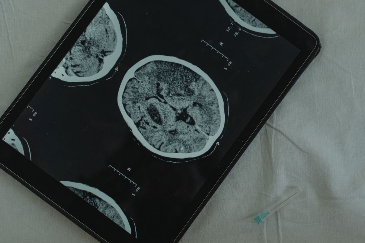 Recent Studies Highlight Potential Mental Health Benefits of GLP-1 Medications