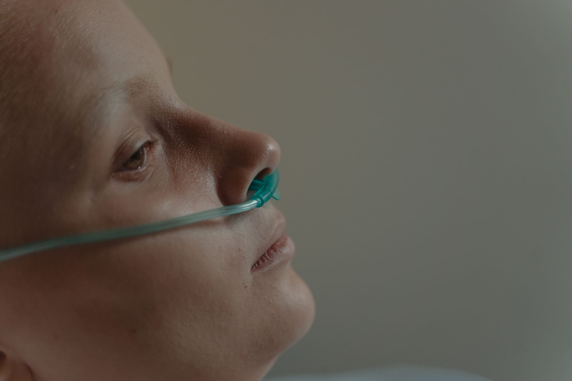 Spravato (Esketamine) Nasal Spray: A Comprehensive Guide for Depression Treatment