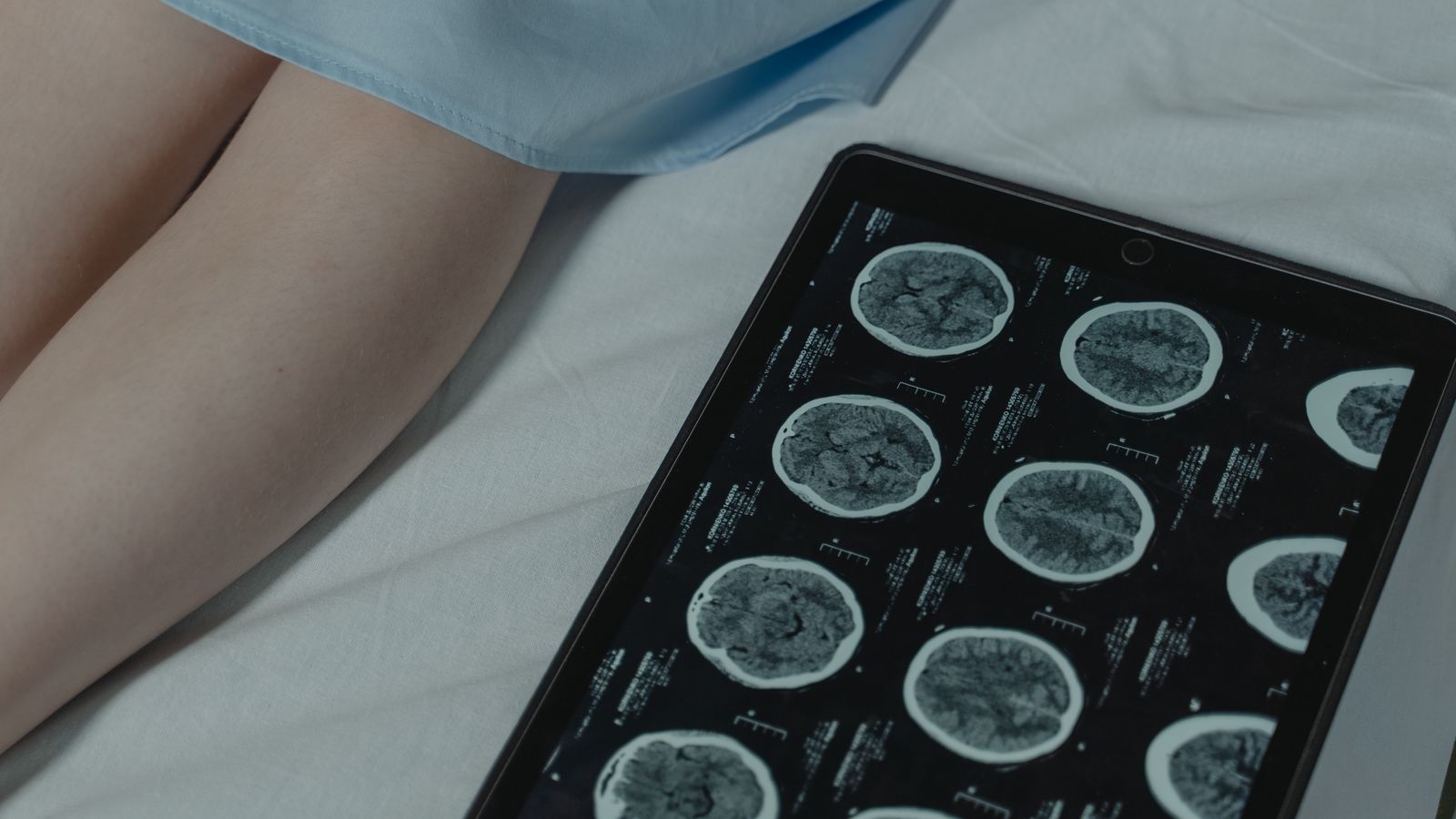 Close-up of brain CT scan display on tablet beside patient's legs in a hospital room.