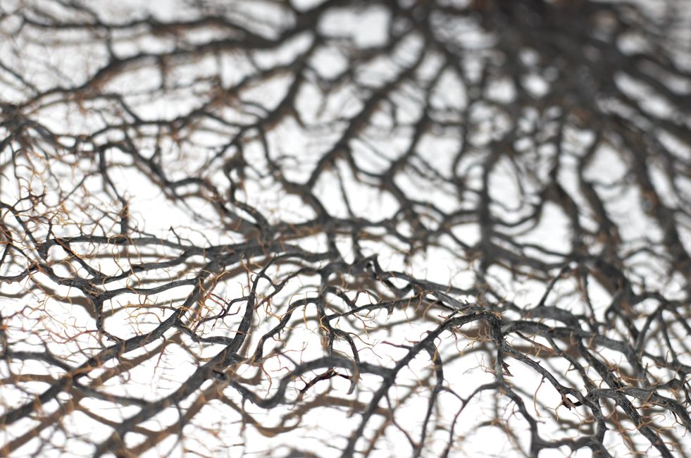 Picture for The protective brain cells that may be working against us as we age