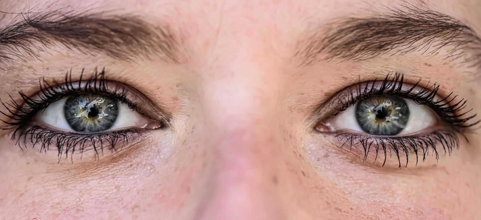 Close-up of human eyes showing detail relevant to eye strain and eye yoga exercises