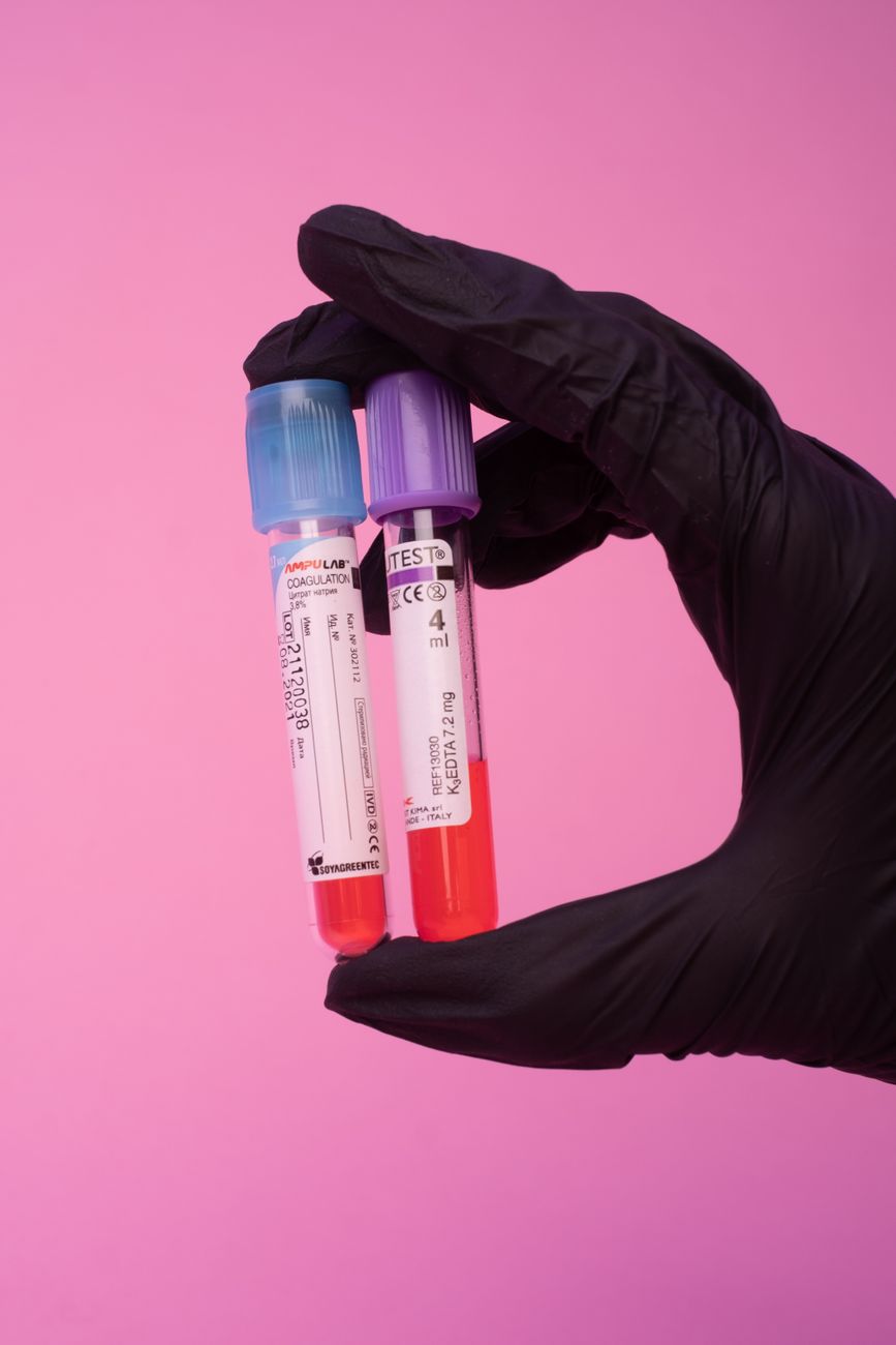 Laboratory blood-sample testing that reflects the study's focus on lipid and glucose markers