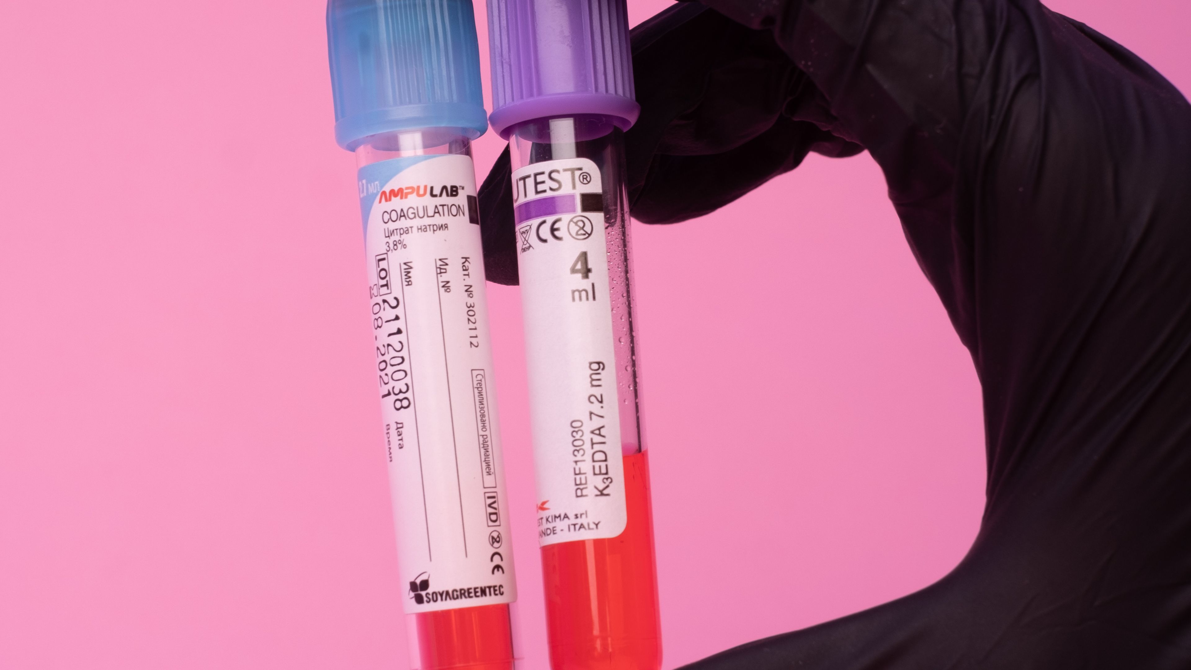 Laboratory worker carefully handling blood test tubes during critical value assessment