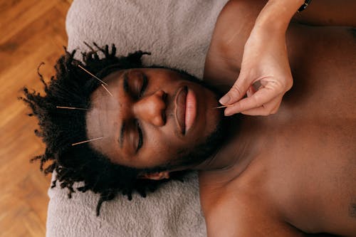 Gratis stockfoto met aanbrengen, acupunctuur, Afrikaanse man Stockfoto