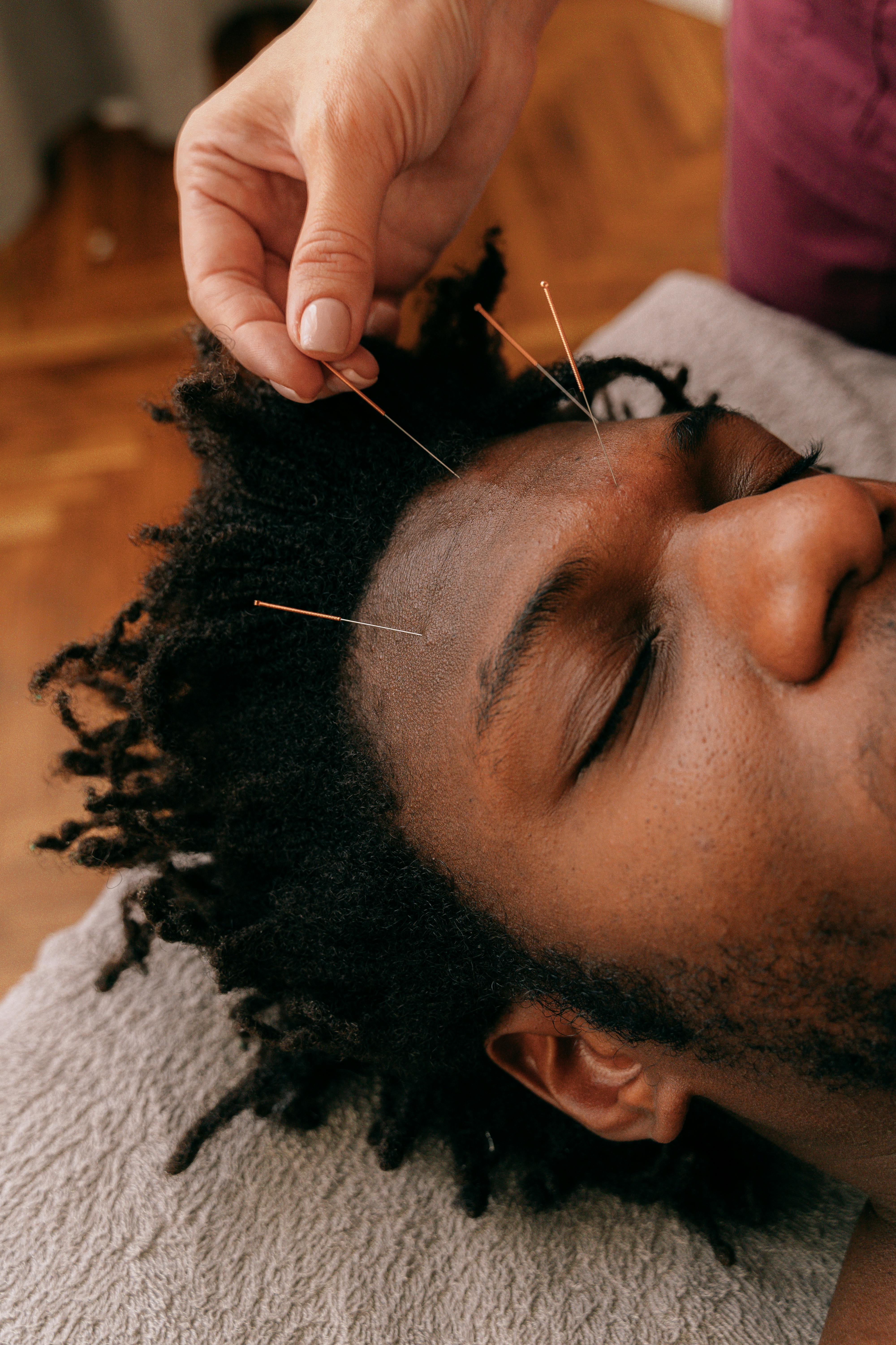 a person inserting needle on a man s forehead