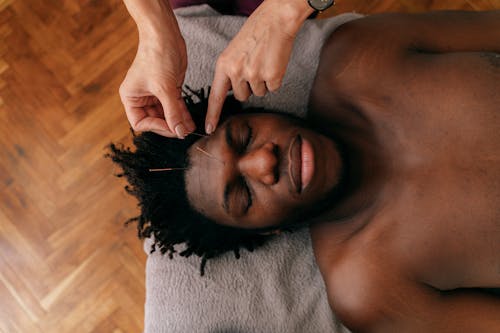 Základová fotografie zdarma na téma akupunktura, čelo, černoch