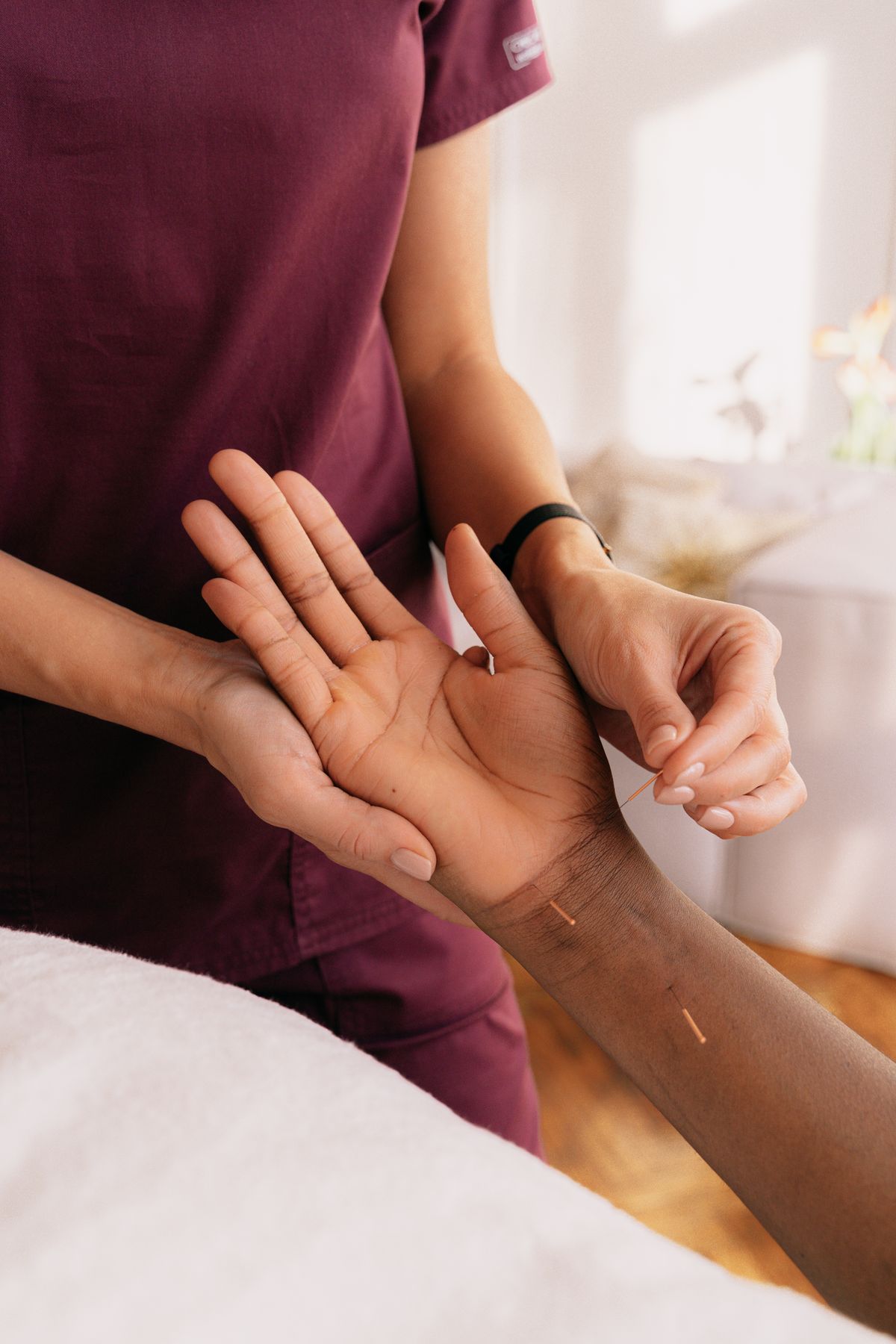 Acupuncture treatment session at Oriental Wellness Medical Group