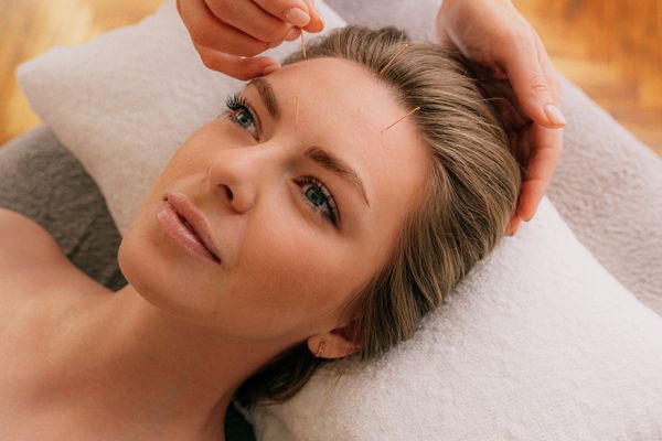 Acupuncture session for IVF preparation