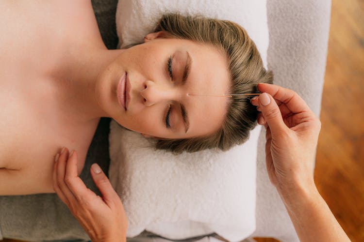 Woman Receiving An Acupuncture Treatment