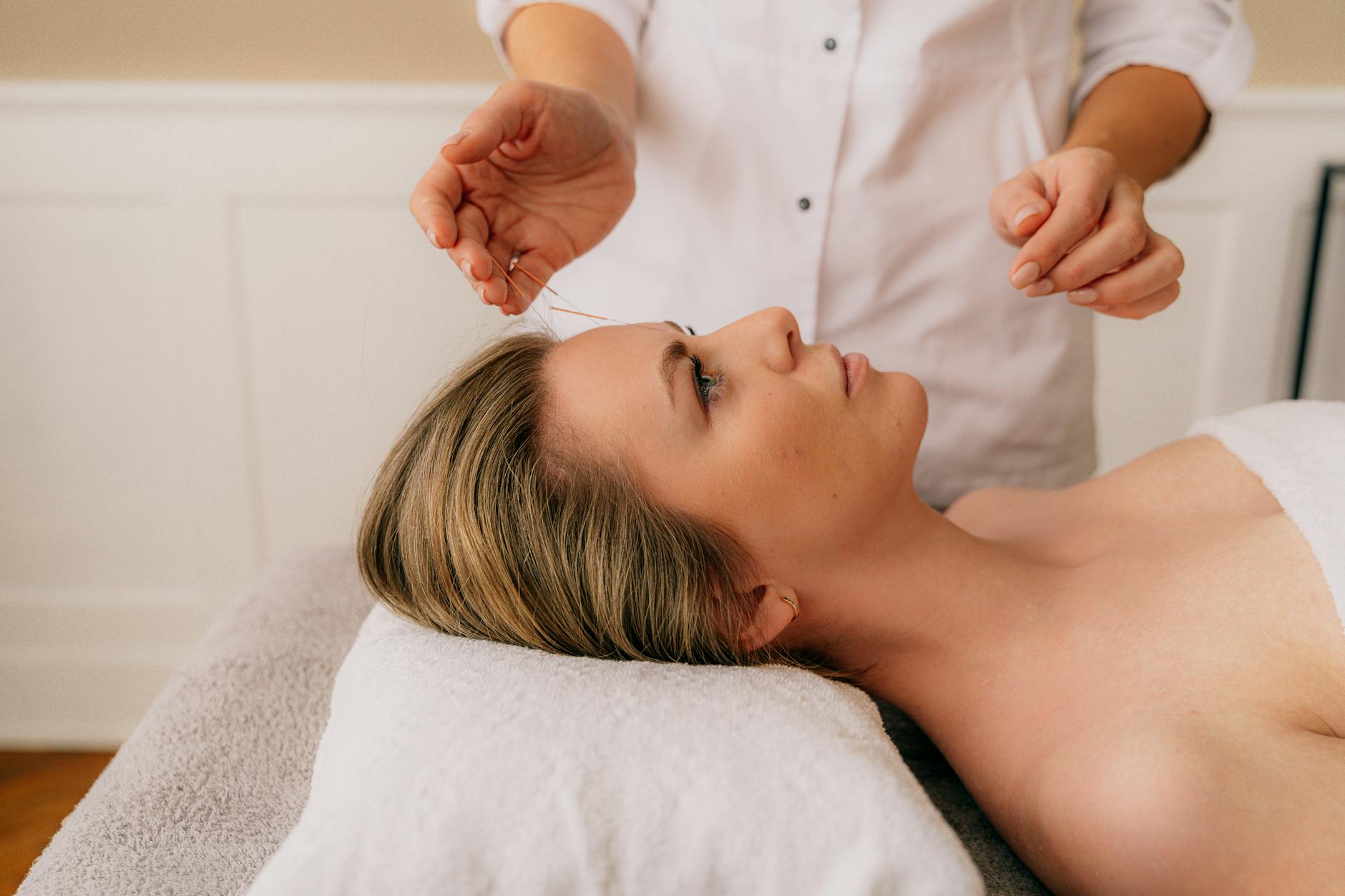 Woman receiving acupuncture therapy in a calm and soothing spa environment.