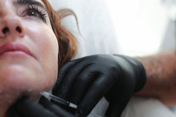 woman getting filler injected for chin
