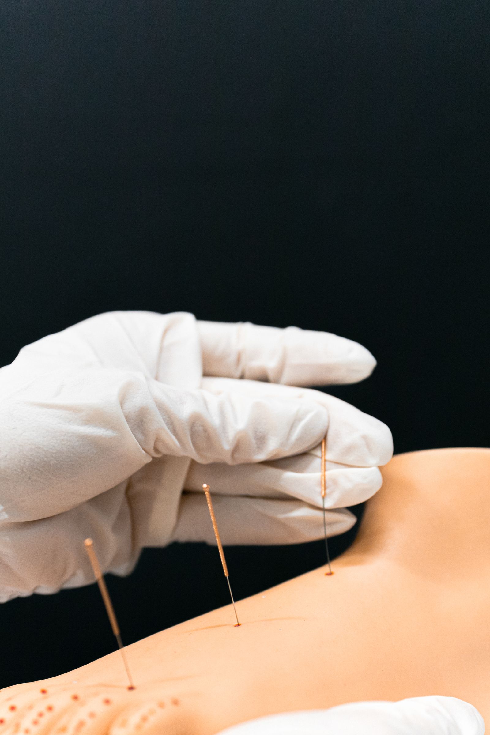 Acupuncteur