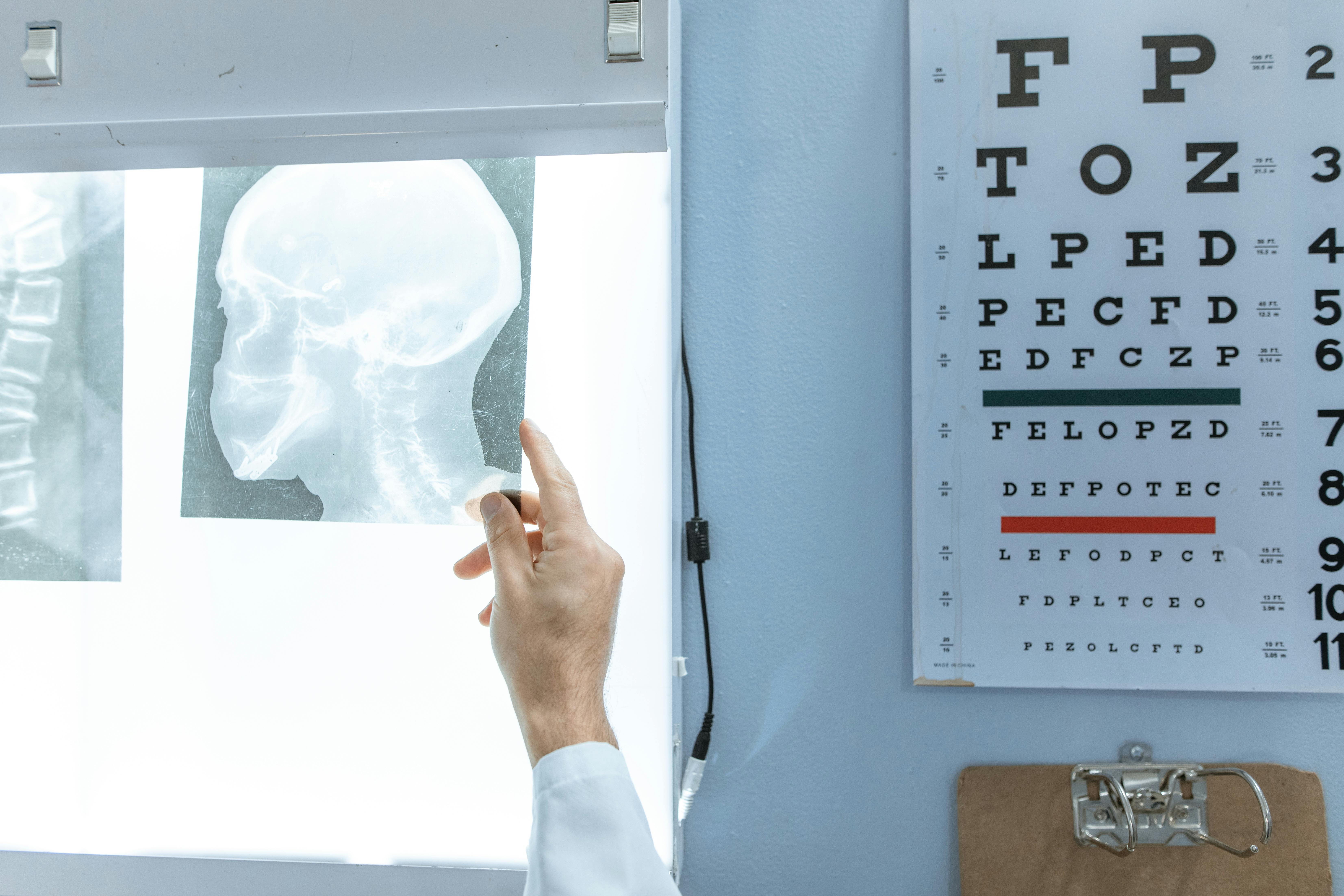 965 Snellen Eye Chart Stock Photos - Free & Royalty-Free Stock