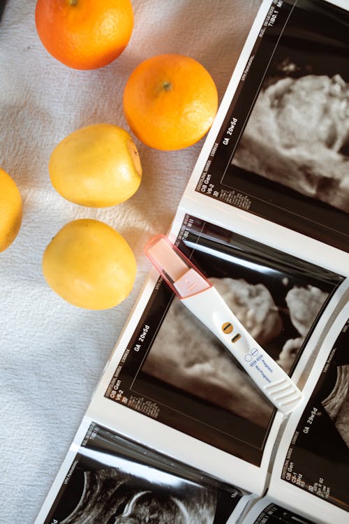 Oranges and Lemons Near Ultrasound Image