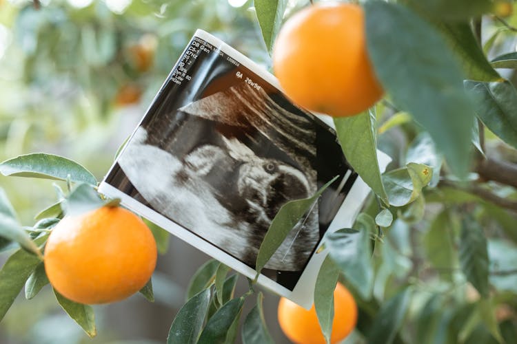 Orange Fruit Tree And Ultrasound Result