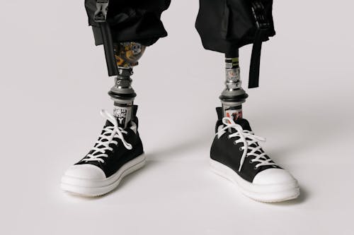 Close-Up Shot of Prosthetic Legs Wearing Sneakers