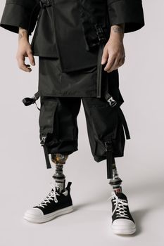 Model in modern attire showcasing advanced prosthetic legs.