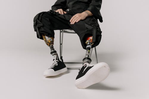 A Person With Prosthesis Sitting on a Chair 