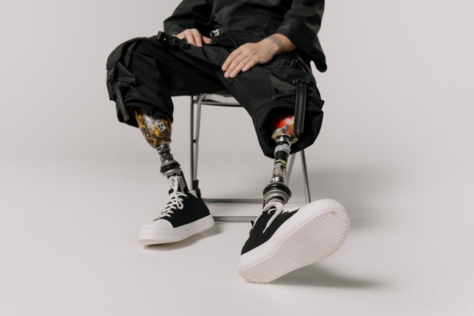 Person walking with a prosthetic leg